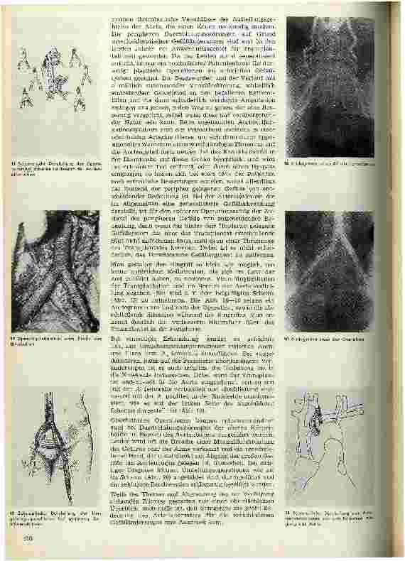 Vorschauseite 4: Über den Ersatz von Arterien 2.Teil
