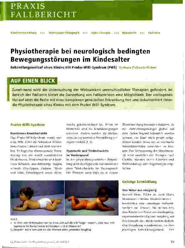 Vorschauseite 1: Physiotherapie bei neurologisch bedingten Bewegungsstörungen im Kindesalter