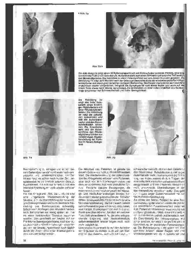 Vorschauseite 2: Ärztliche Indikationen und Kontraindikation zur funktionellen Behandlung Osteosynthesen