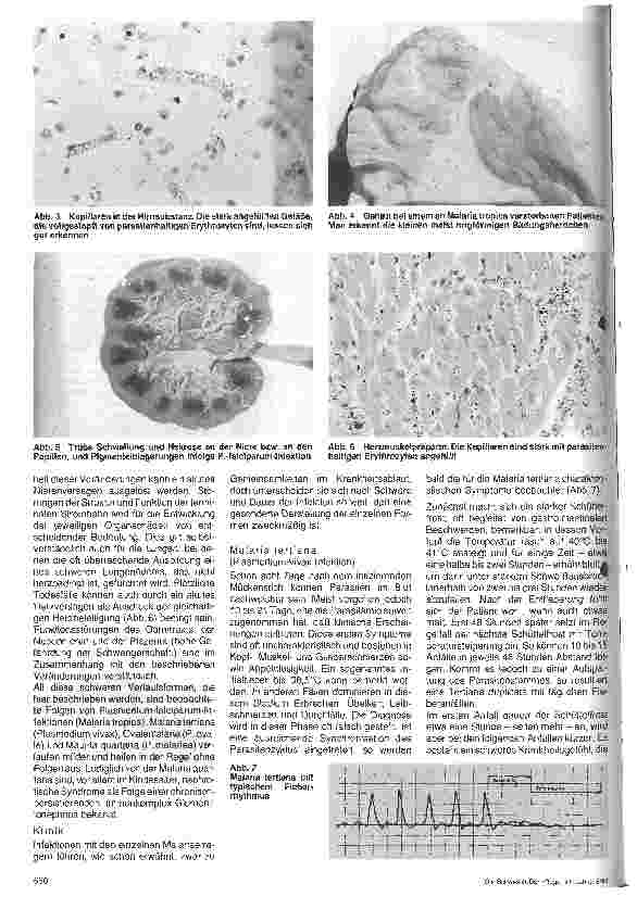 Vorschauseite 2: Malaria