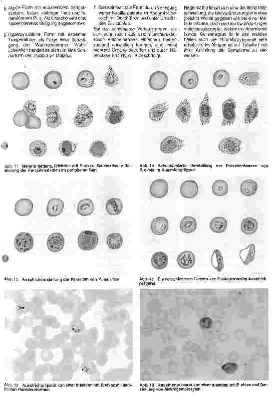 Vorschauseite 5: Malaria