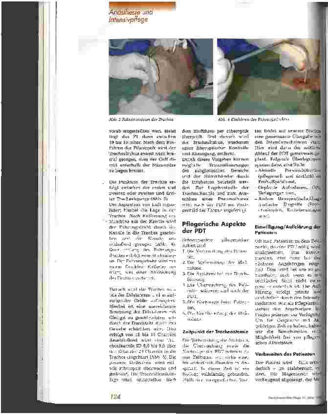 Vorschauseite 3: Die Perkutane Dilatationstracheostomie aus pflegerischer Sicht