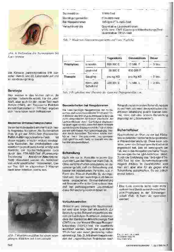 Vorschauseite 3: Lues connata