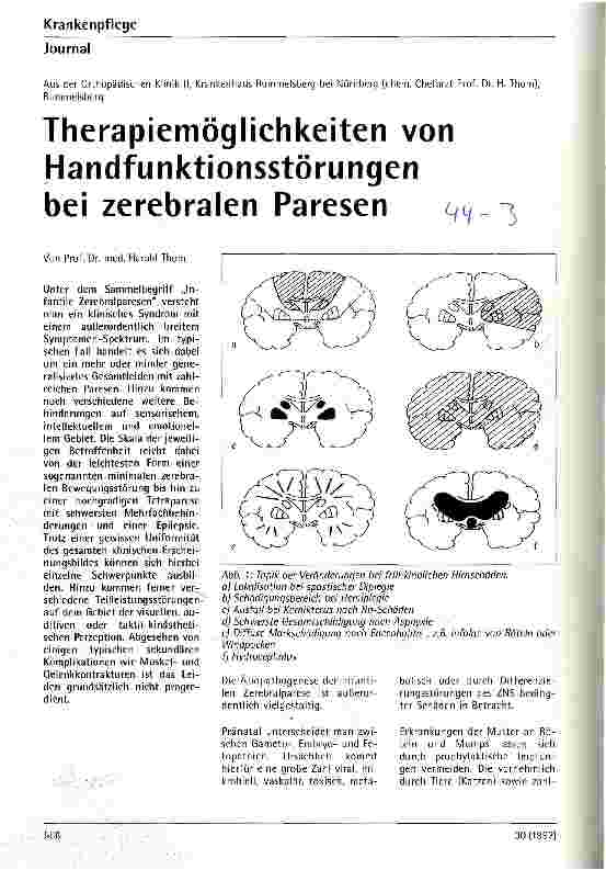 Vorschauseite 1: Therapiemöglichkeiten von Handfunktionsstörungen bei zerebralen Paresen