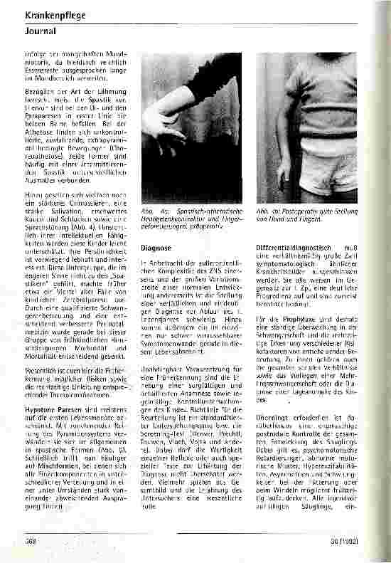 Vorschauseite 3: Therapiemöglichkeiten von Handfunktionsstörungen bei zerebralen Paresen