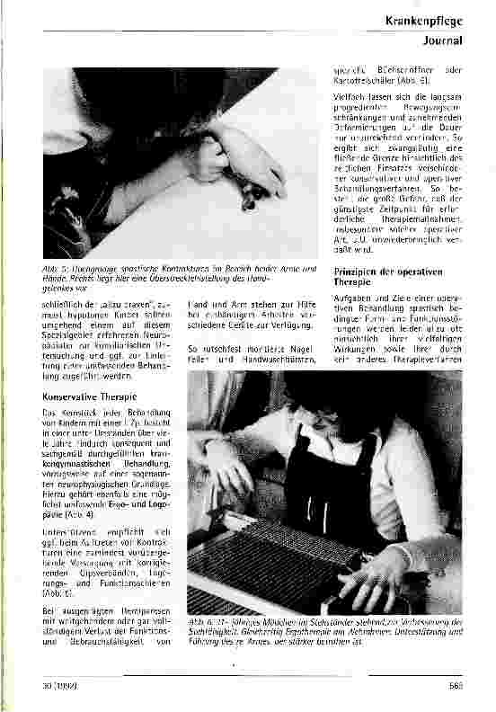 Vorschauseite 4: Therapiemöglichkeiten von Handfunktionsstörungen bei zerebralen Paresen
