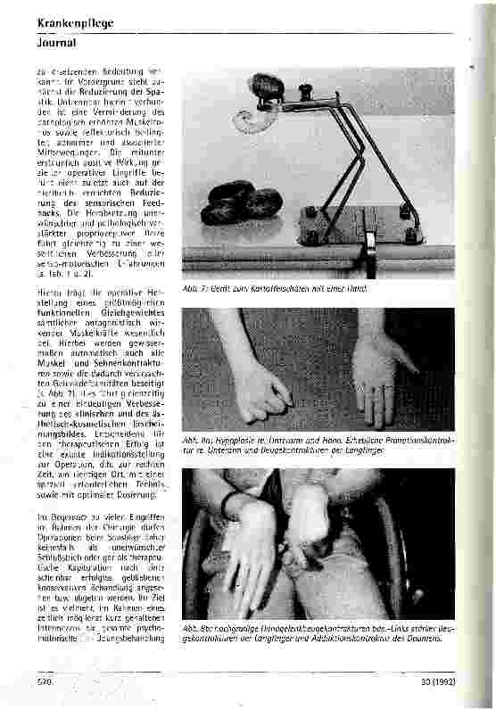 Vorschauseite 5: Therapiemöglichkeiten von Handfunktionsstörungen bei zerebralen Paresen