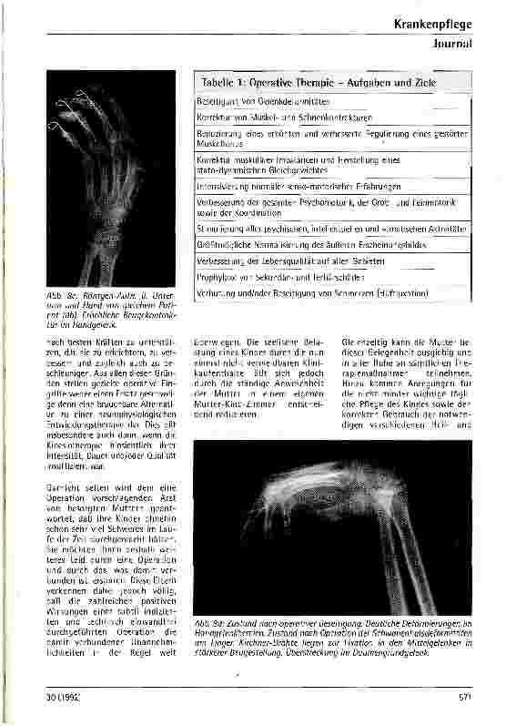 Vorschauseite 6: Therapiemöglichkeiten von Handfunktionsstörungen bei zerebralen Paresen