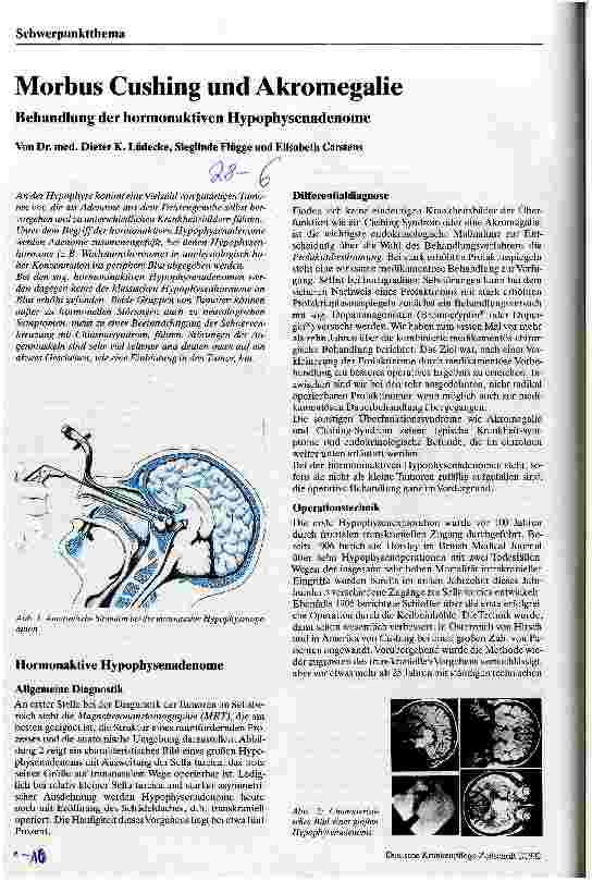 Vorschauseite 1: Morbus Cushing und Akromegalie Behandlung der hormonaktiven Hypophysenadenome