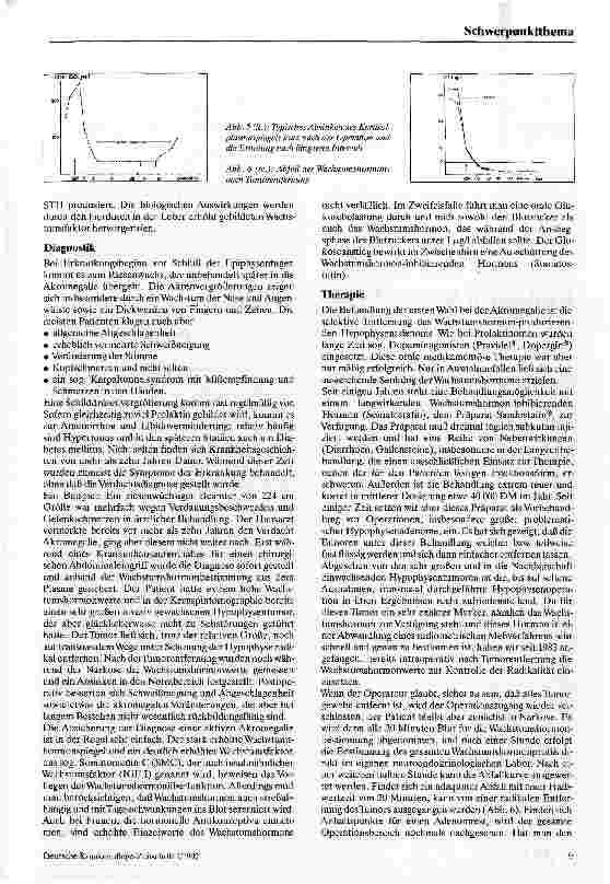Vorschauseite 4: Morbus Cushing und Akromegalie Behandlung der hormonaktiven Hypophysenadenome