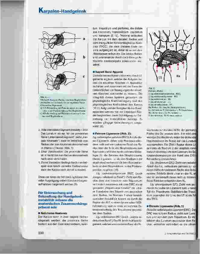 Vorschauseite 3: Diagnostik und Therapie der perilunären karpalen Instabilität
