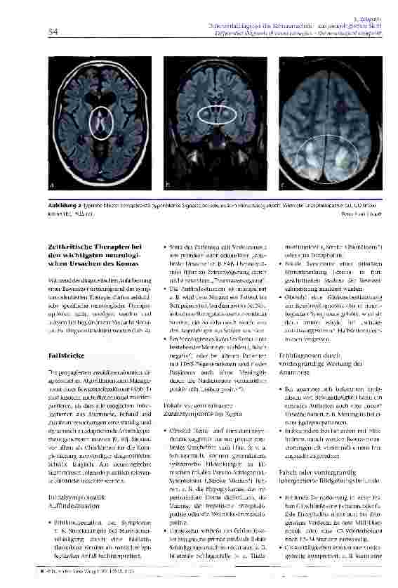 Vorschauseite 5: Differentialdiagnose der Komaursachen - aus neurologischer Sicht