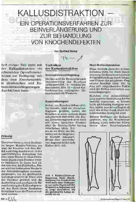 Vorschauseite 1: Kallusdistraktion - ein Operationsverfahren zur Beinverlängerung und zur Behanldung von Knochendefekten