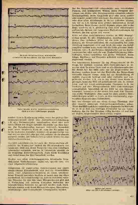 Vorschauseite 2: Über die Bedeutung des EEGs