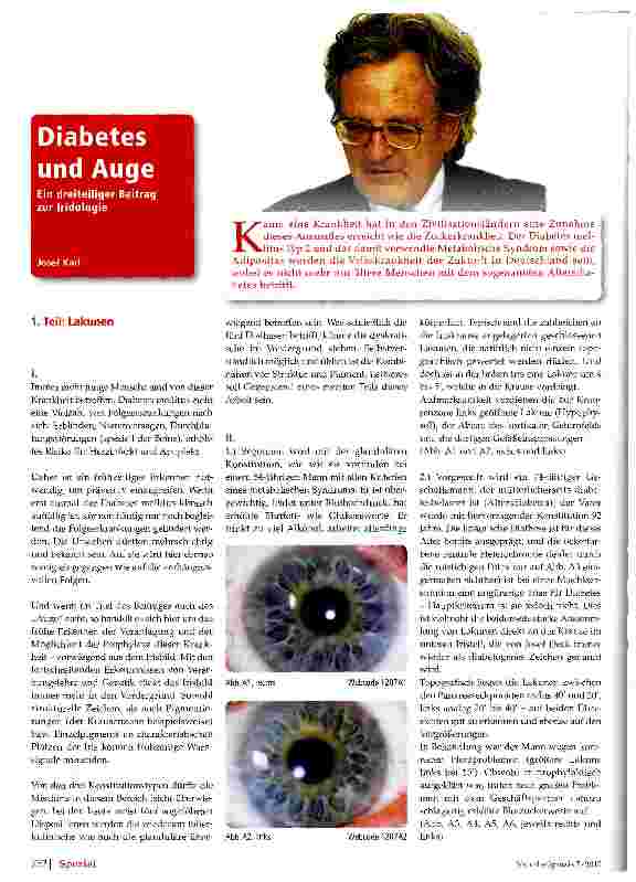 Vorschauseite 1: Diabetes und AugeEin dreiteiliger Beitrag zur Indologie