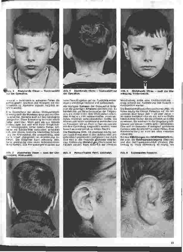 Vorschauseite 2: Einführung in die Hals - Nasen - Ohren - Heilkunde 3. Folge: Das Ohr - Erkrankungen des äußeren Ohres