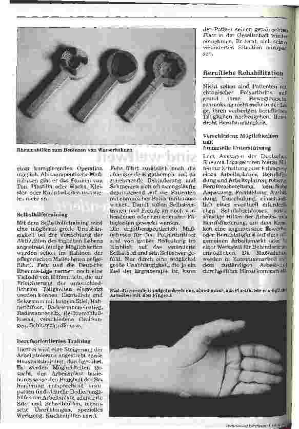 Vorschauseite 6: Pflege eines Patienten mit chronischer Polyarthritis 4. Folge (Schluß): Pflegemaßnahmen und Rehabilitation