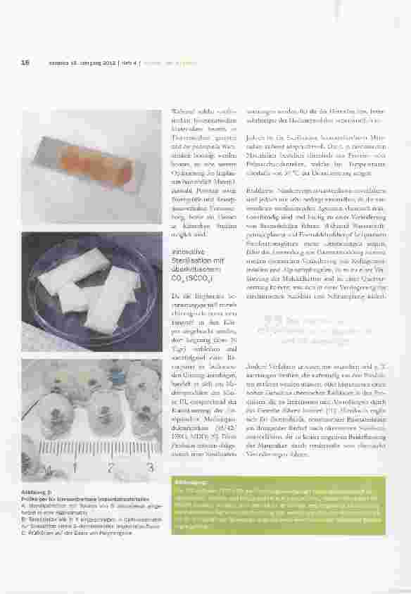 Vorschauseite 3: Entwicklung neuartiger bioresorbierbarer Implantatmaterialien und geeigneter Niedertemperatursterilisationsverfahren auf der Basis von überkritischem CO2