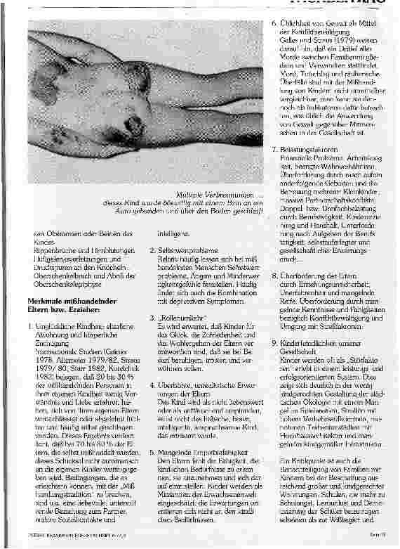 Vorschauseite 2: Kindesmißhandlung