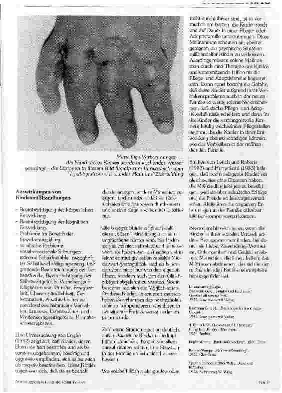 Vorschauseite 4: Kindesmißhandlung