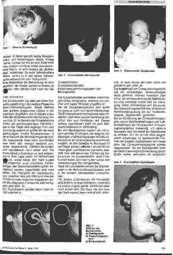 Vorschauseite 2: Kraniale und spinale Fehlbildungen Neurochirurgische Krankheitsbilder