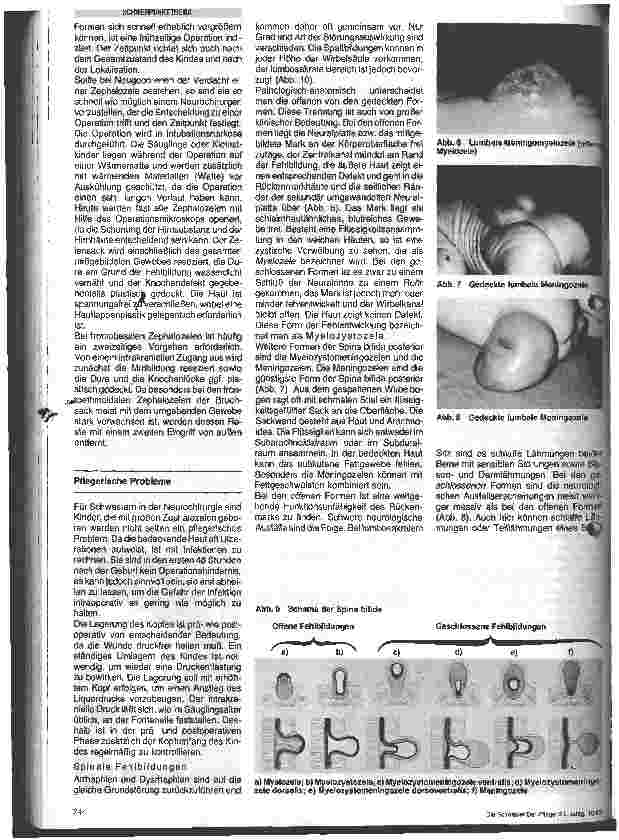 Vorschauseite 3: Kraniale und spinale Fehlbildungen Neurochirurgische Krankheitsbilder
