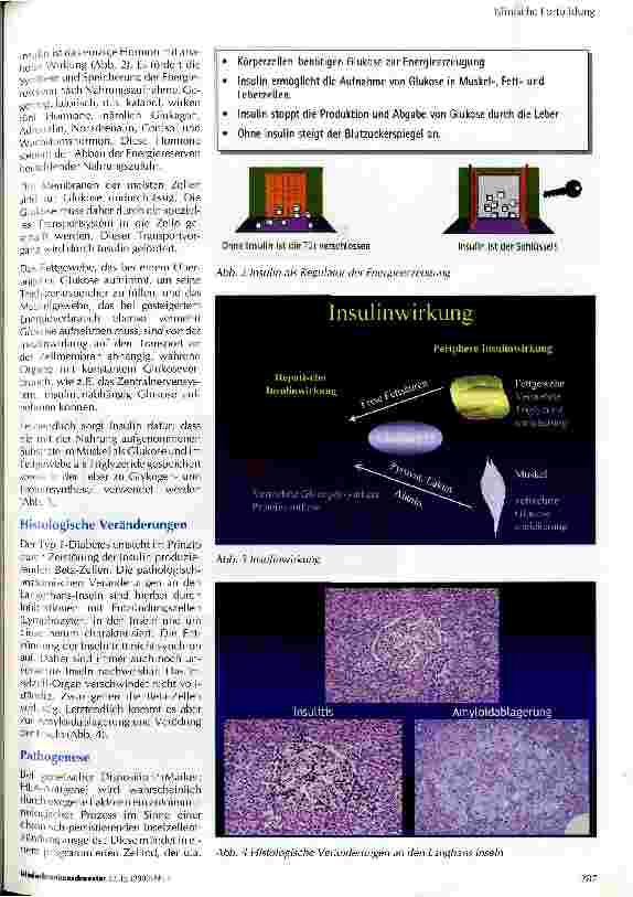 Vorschauseite 2: Pathophysiologie des Diabetes mellitus (Typ 1)