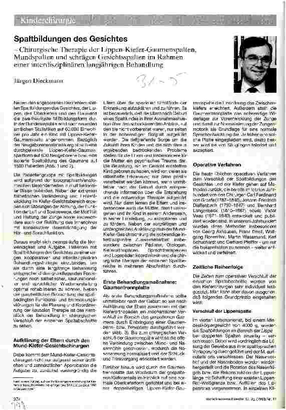 Vorschauseite 1: Spaltbildungen des Gesichtes Chirurgische Therapie der Lippen-Kiefer- Gaumenspalten, Mundspalten und schrägen Gesichtsspalten ... interdiszip