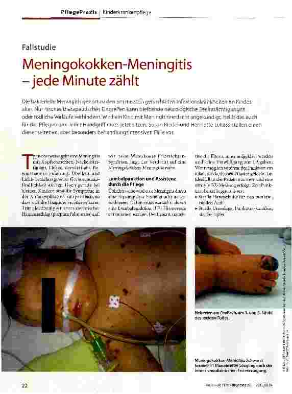 Vorschauseite 1: Meningokokken-Meningitis -jede Minute zählt