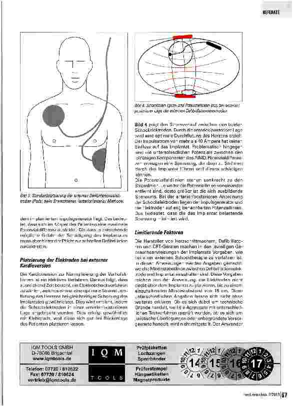 Vorschauseite 3: Empfehlungen zur Defibrillation und Kardioversion bei Patienten mit implantiertem Herzschrittmacher, Defibrillator oder CRT-Gerät