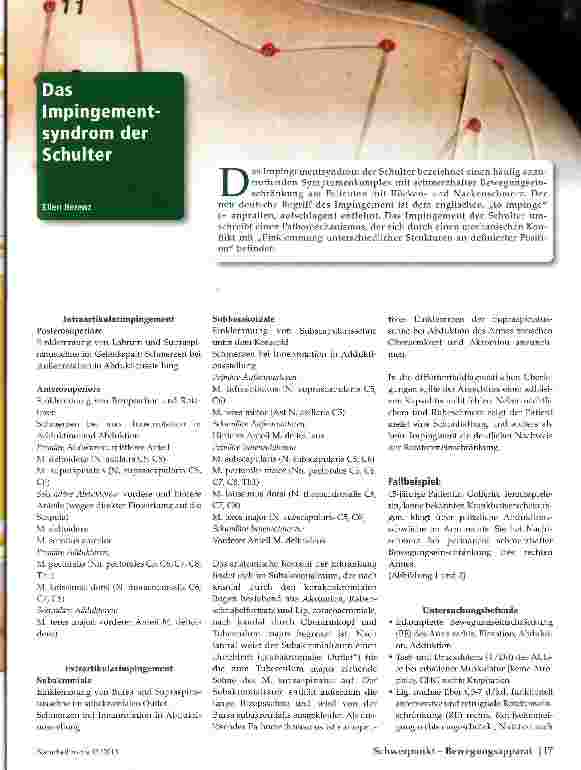 Vorschauseite 1: Das Impingementsyndrom der Schulter