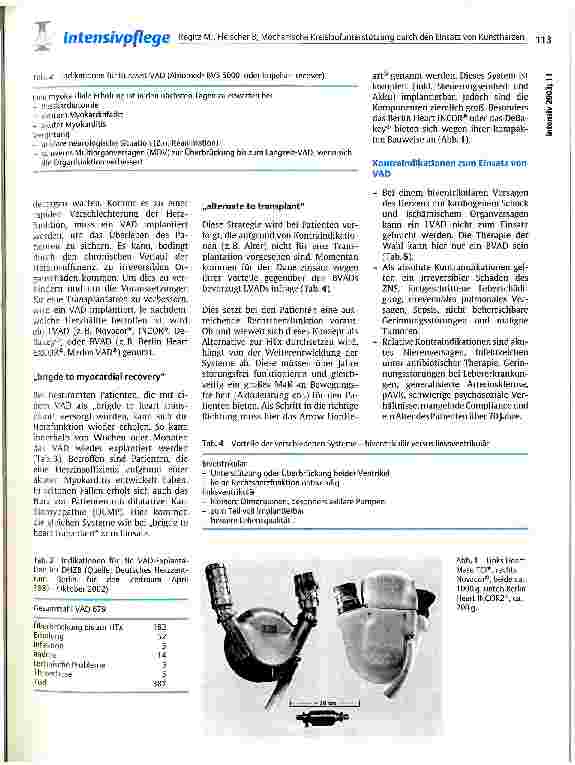 Vorschauseite 2: Mechanische Kreislaufunterstützung durch den Einsatz von Kunstherzen