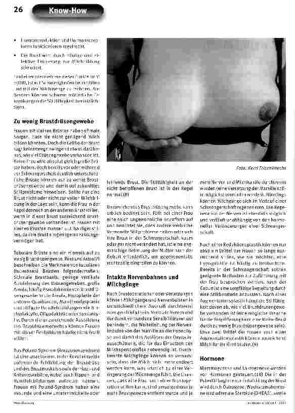Vorschauseite 2: Zu wenig Milch