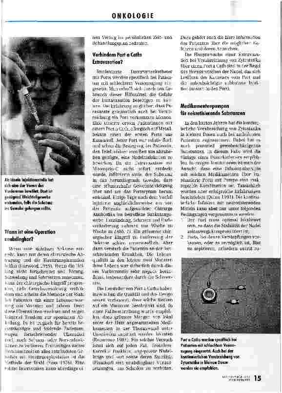 Vorschauseite 5: Wie ein Paravasat verhindert werden kann Verabreichen von Zytostatika