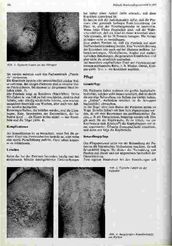 Vorschauseite 2: Pflege und psychische Betreuung von Hautkrankheiten