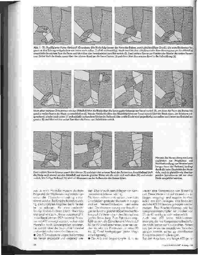Vorschauseite 2: Physikalische Thrombose-Prophylaxe Praxis Tips Teil 2
