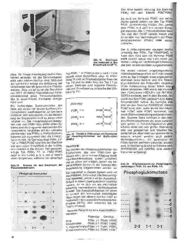 Vorschauseite 5: Transfusionskunde, Blutgruppenserologie und Immunhämatologie 24.Folge: Erbliche Blutmerkmale in den Erythrozyten