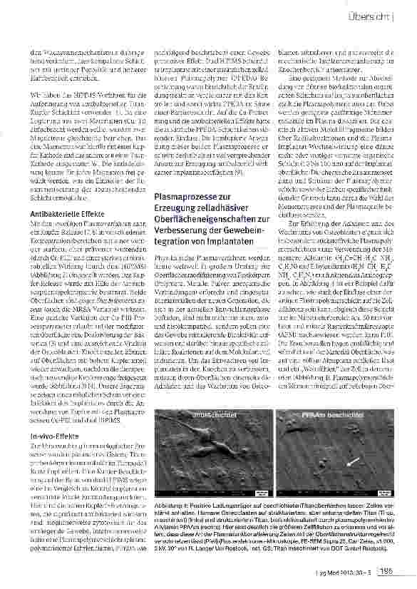 Vorschauseite 4: Physikalische Plasmaprozesse zurOberflächen-Funktionalisierung von Implantaten für die Orthopädische Chirurgie