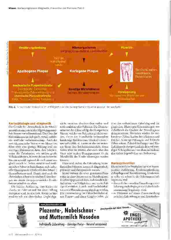Vorschauseite 3: Zahngesundheit und frühkindliche Karies (Teil I): Ursachen und Prävention