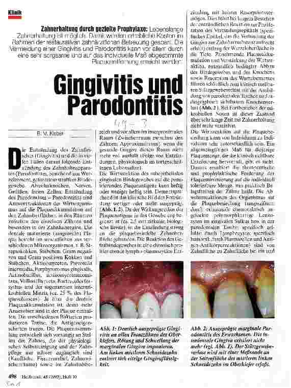 Vorschauseite 1: Gingivitis und Parodontitis Zahnerhaltung durch gezielte Prophylaxe