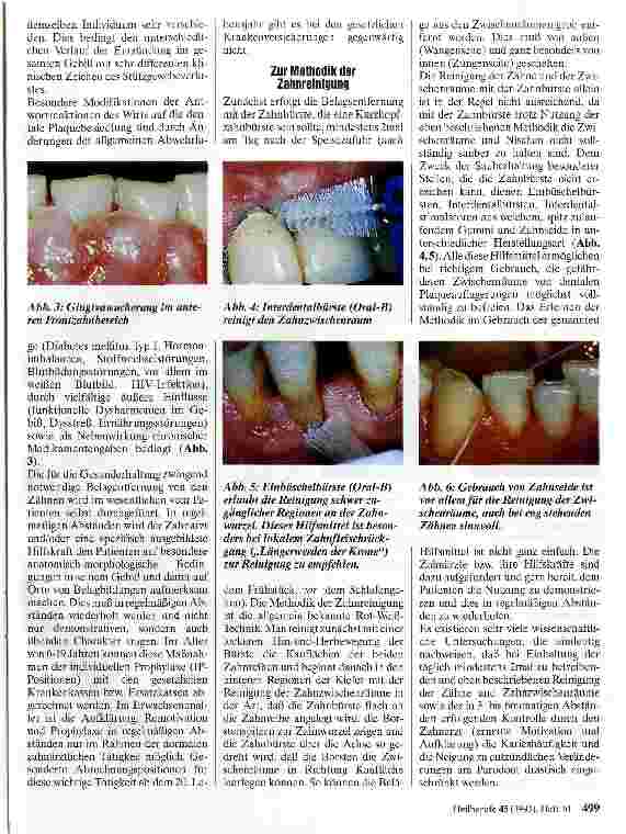 Vorschauseite 2: Gingivitis und Parodontitis Zahnerhaltung durch gezielte Prophylaxe