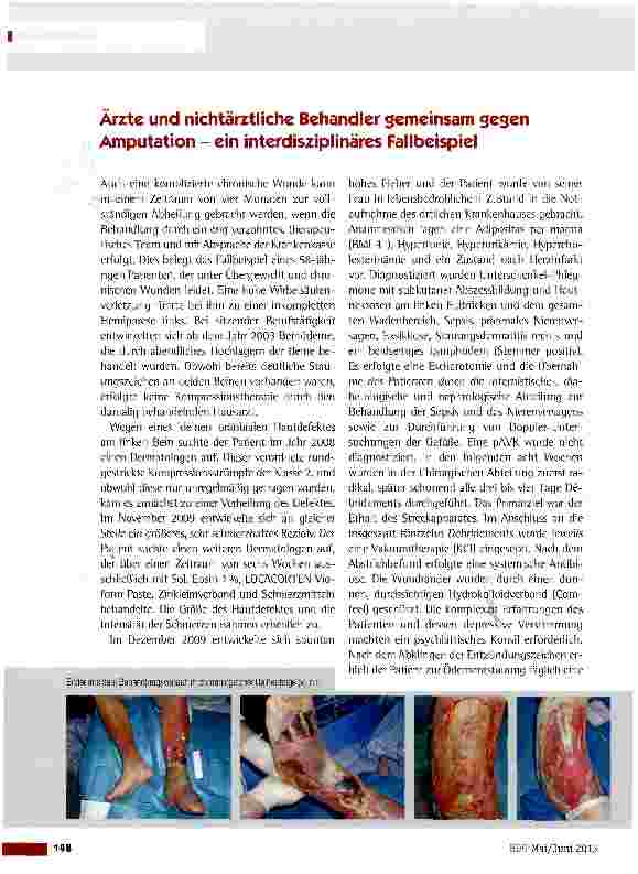 Vorschauseite 1: Ärzte und nichtärztliche Behandler gemeinsam gegen Amputation - ein interdisziplinäres Fallbeispiel