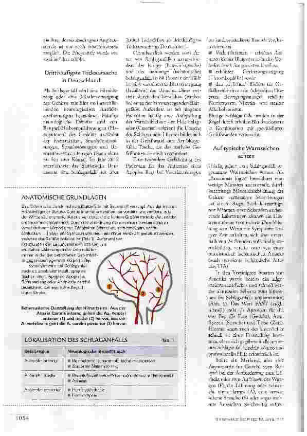 Vorschauseite 3: SCHLAGANFALL- EIN DRINGENDER NOTFALL!