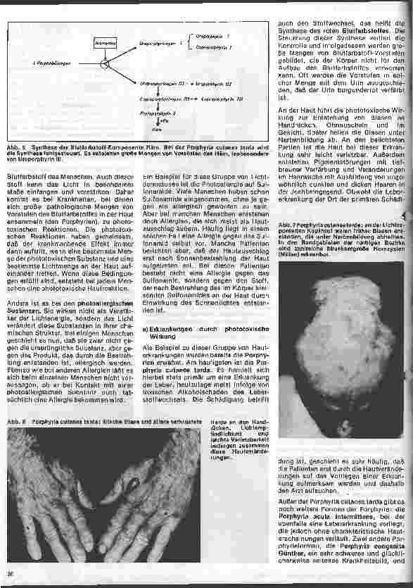 Vorschauseite 3: Arbeitsgebiete der modernen Dermatologie 2. Folge:Krankheiten der Haut durch sichtbares u. ultraviolettes Licht