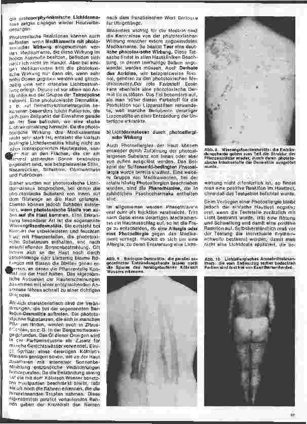 Vorschauseite 4: Arbeitsgebiete der modernen Dermatologie 2. Folge:Krankheiten der Haut durch sichtbares u. ultraviolettes Licht