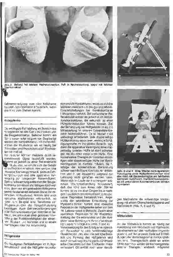 Vorschauseite 2: Die orthopädische Versorgung des Spina-bifida-Kindes