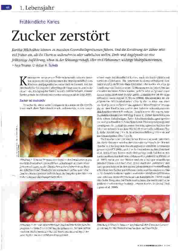 Vorschauseite 1: Zucker zerstört