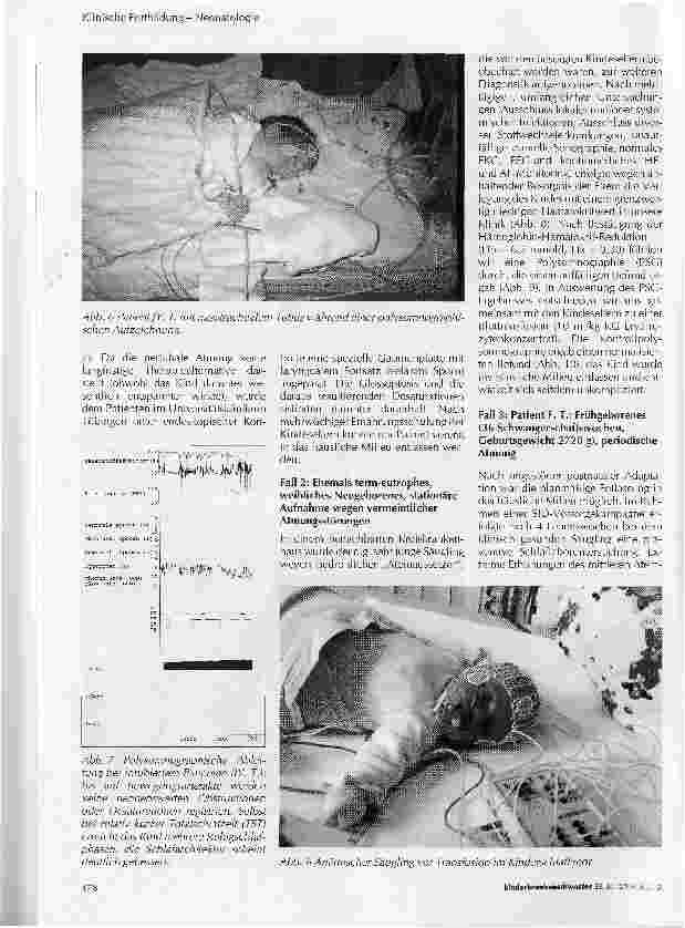 Vorschauseite 4: Bedeutung der Schlafmedizin für die Neonatologie