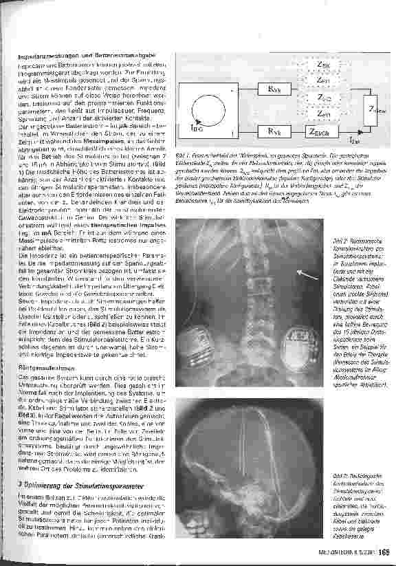Vorschauseite 2: Zur Technik der TiefenhirnstimulationSystemkontrolle und Optimierung der Stimulationsparameter - Teil 2