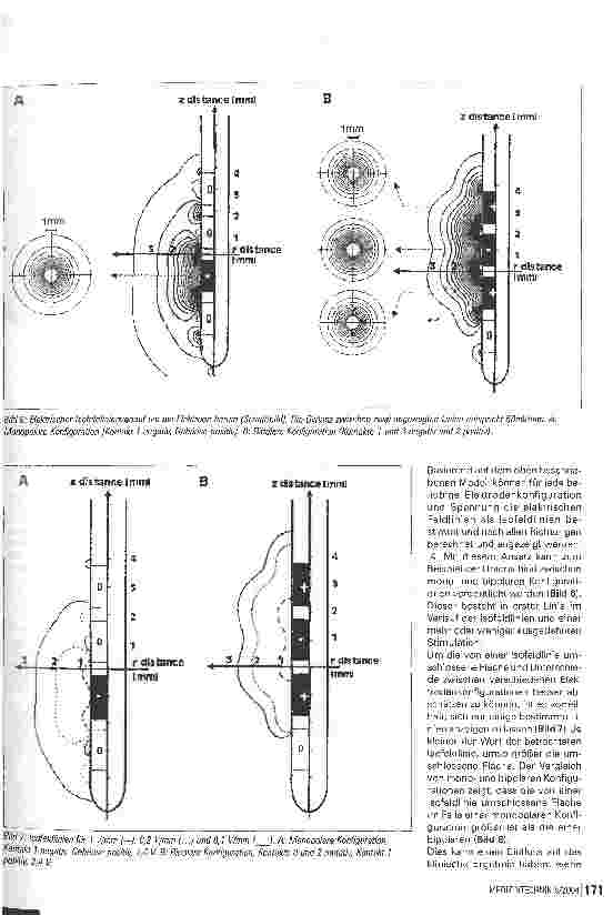 Vorschauseite 4: Zur Technik der TiefenhirnstimulationSystemkontrolle und Optimierung der Stimulationsparameter - Teil 2